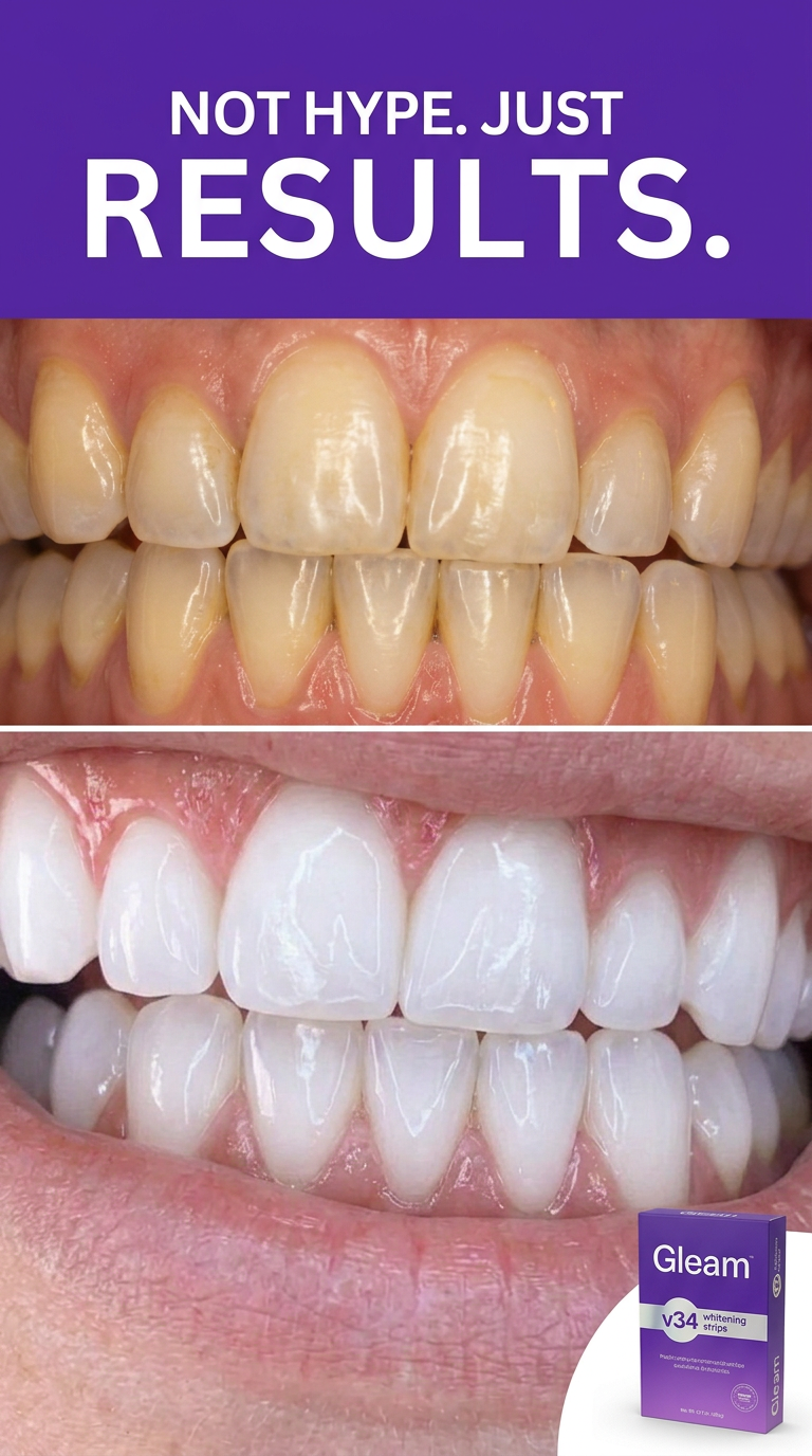 GLEAM Whitening Strips